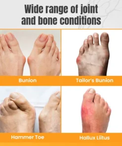 Ceoerty™ HalluxWell BeeVenom Therapy Cream