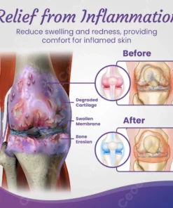 Ceoerty™ JointCure Organic Comfrey Salve