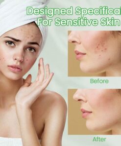 Ceoerty™ Nightly ClearSkin Patch