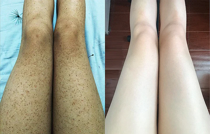 Ceoerty™ Nourishing Repair Exfoliating Scrub