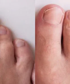 Ceoerty™ Rapid Nail Growth and Fortifying Serum