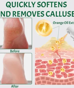 Ceoerty™ SmoothFeet Callus Remover Spray