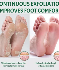 Ceoerty™ SmoothFeet Callus Remover Spray