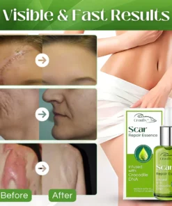 Croufix™ Scar Repair Essence