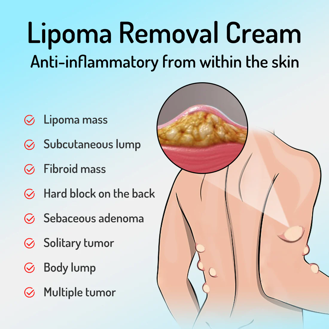 Cvreoz™ Bee Venom Lipoma Removal Cream