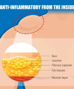 Cvreoz™ Bee Venom Lipoma Removal Cream