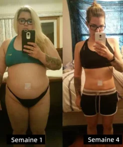 Cvreoz™ Le patch amincissant au venin d'abeille