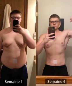 Cvreoz™ Le patch amincissant au venin d'abeille