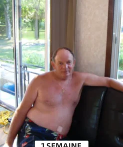 Cvreoz™ Le patch amincissant au venin d'abeille