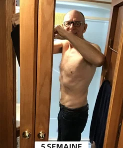 Cvreoz™ Le patch amincissant au venin d'abeille