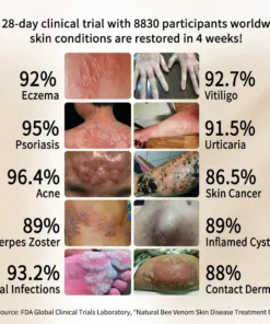 Cvreoz™ Natural Bee Venom Skin Disease Treatment Cream