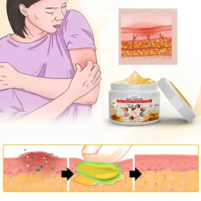 Cvreoz™ Natural Bee Venom Skin Disease Treatment Cream