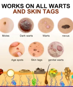 Cvreoz™ PRO Bee Venom Mole and Wart Treatment Cream