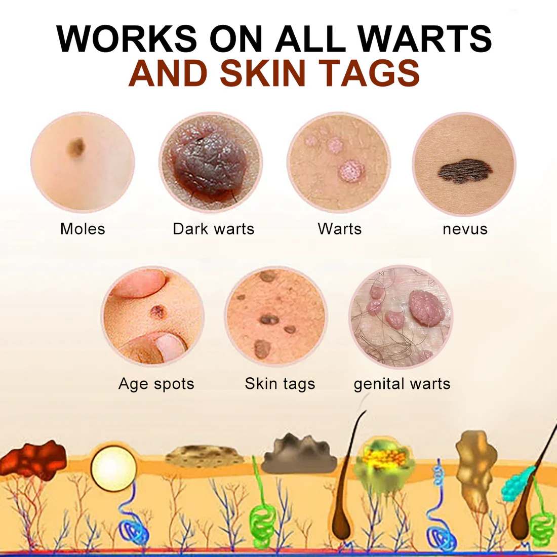 Cvreoz™ PRO Bee Venom Mole and Wart Treatment Cream