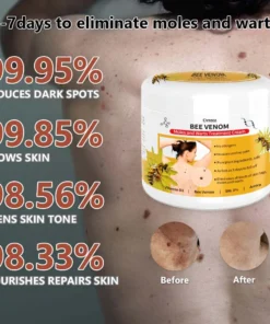 Cvreoz™ PRO Bee Venom Mole and Wart Treatment Cream
