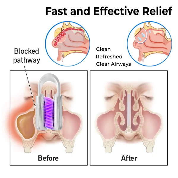 DIYSTAR ™ Nasal Mucus Cleaning Device
