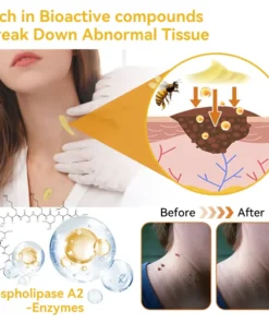 DOCTIA™ Bee Venom Medical Grade Scar Remove Advanced Gel