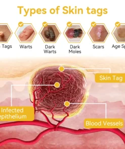 DOCTIA™ Bee Venom Medical Grade Scar Remove Advanced Gel