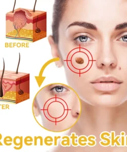 DOCTIA™ Bee Venom Medical Grade Scar Remove Advanced Gel