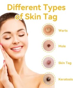 DOCTIA™ Bee Venom Medical Grade Scar Remove Advanced Gel