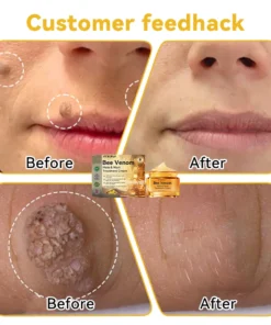 DOCTIA™ Bee Venom Medical Grade Scar Remove Advanced Gel