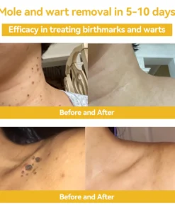 DOCTIA™ Bee Venom Medical Grade Scar Remove Advanced Gel