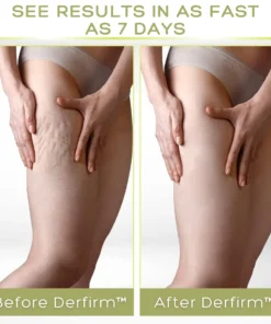 Derfirm™ Collagen Firming Body Cream