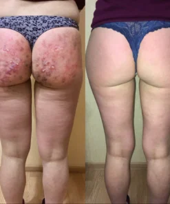 Diapason® Bee Venom Feminine Repair Tighten Detox Yoni Capsules34