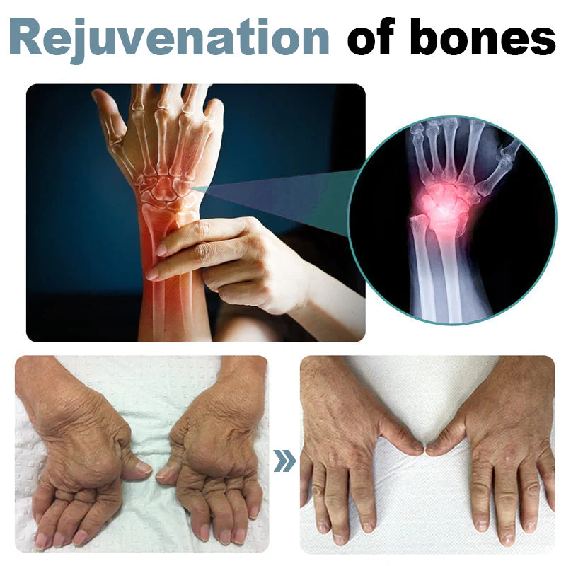 Dobshow™ Bee Venom Joint & Bone Repair Advanced Moisturizing Cream