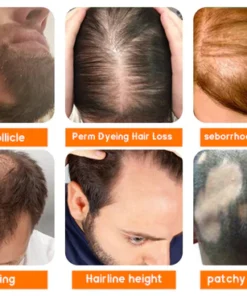 Dobshow™ Premium Biotin Hair&Beard Booster Atomizing