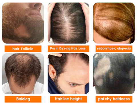 Dobshow™ Premium Biotin Hair&Beard Booster Atomizing