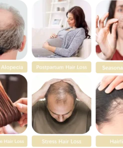 Dobshow™ Rosemary Hair Regrowth & Conditioning Oil