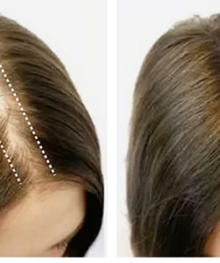 Dobshow™ Rosemary Hair Regrowth & Conditioning Oil