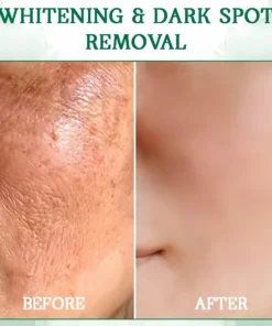 Dobshow™ Skin Firming Renewing Serum