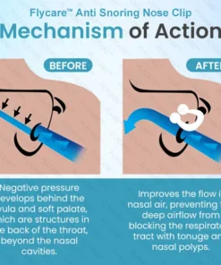 FLYCARE™ Anti Snoring Nose Clip