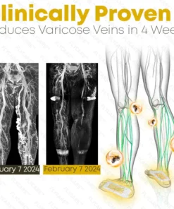 FLYCARE™ Bee Venom Varicosities Healing Pads