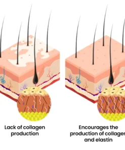 FLYCARE™ Bee Venom Vitiligo Cream