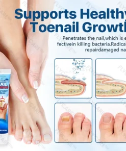 FLYCARE™ Candiclear Nail Fungus Treatment Cream