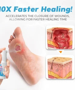 FLYCARE™ Fast Diabetic Wounds Healing Spray