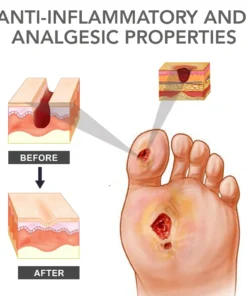 FLYCARE™ Fast Diabetic Wounds Healing Spray