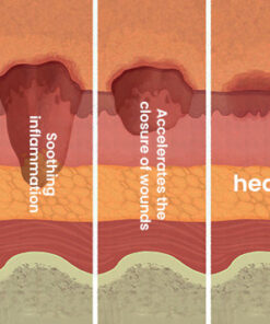 FLYCARE™ Fast Diabetic Wounds Healing Spray