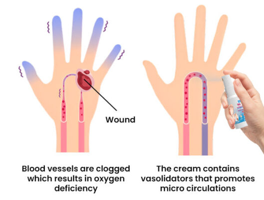 FLYCARE™ Fast Diabetic Wounds Healing Spray