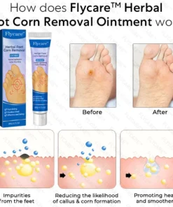 FLYCARE™ Herbal Foot Corn Removal Ointment