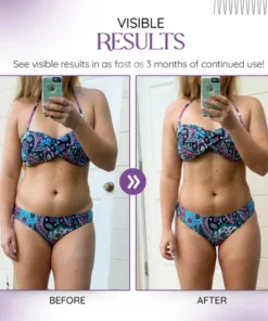 FLYCARE™ Kenyan Purple Leaves Weight Loss Cream