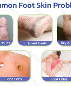 FLYCARE™ PediSpa Foot Scrub Spray