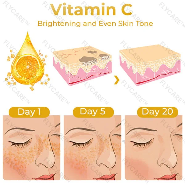 FLYCARE™ Skin Melanin Correcting Facial Serum
