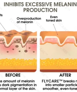 FLYCARE™ Skin Whitening Essence Capsules