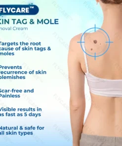 FLYCARE™ Wart Removal Oitment