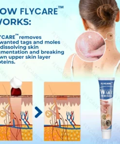 FLYCARE™ Wart Removal Oitment
