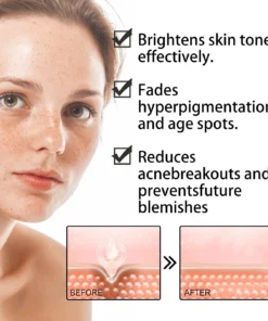 Fast Dark Spot Remover-Dobshow™ Melanin Correcting Facial Serum